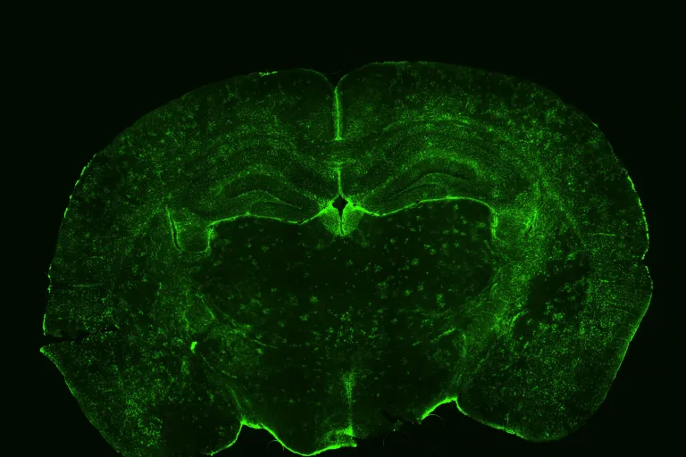 Bulldog brain