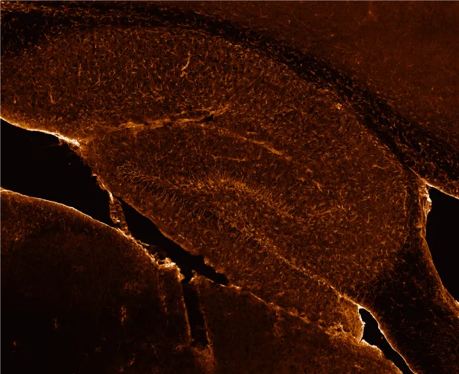 GFAP in the hippocampus_27