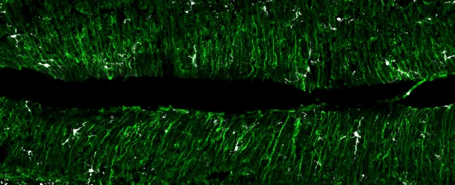 GFAP (green) and Iba1 (white) in the cerebellum_29