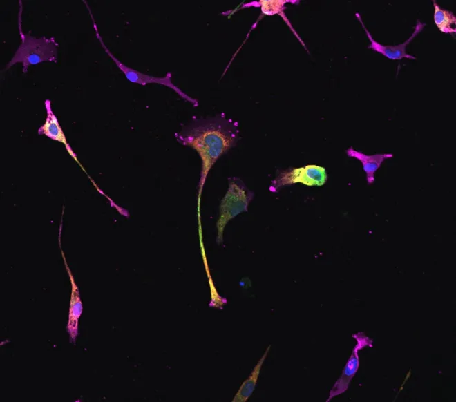 Induced microglia from iPSC_36