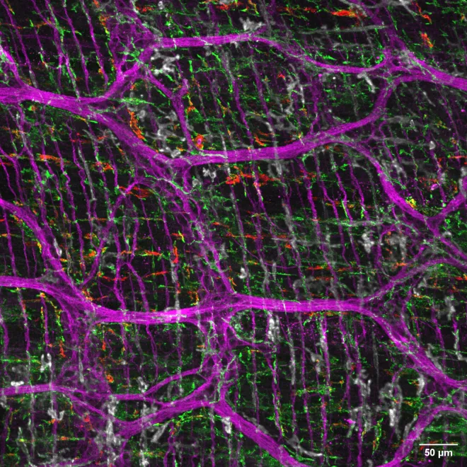 Confocal image of Iba1+ (green), CD163+ (red) and CCR2+ (white) muscularis macrophages in close proximity to the myenteric plexus (bIII tubulin (magenta)) in the inflamed small intestine.