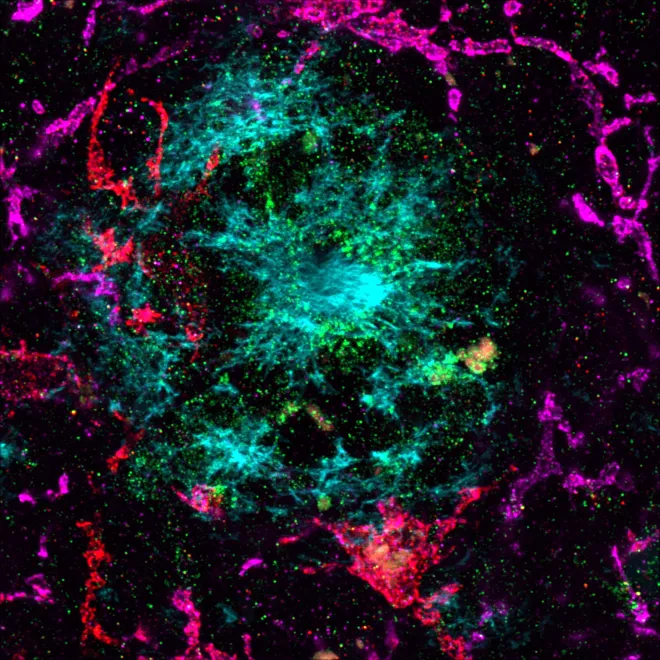 Explosions in the sky -- staining of microglia (P2RY12, HLA - magenta, red), Amyloid-Beta (X-34, blue) and Lamp2 (green) in mouse brain section