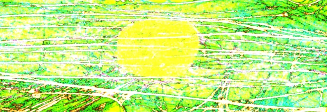 "Cytoskeleton wired nuclear sun" represents stress fibers traversing over the nucleus in a fibroblast cell