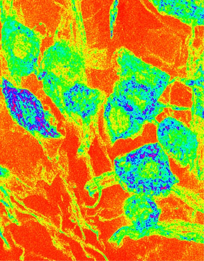 MOTOR NEURON BALOONS FOR THE BRAIN'S BIRTHDAY PARTY shows the cell bodies of motor neurons in the Drosophila larval brain