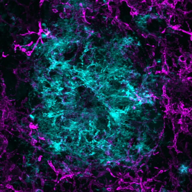 Staining of homeostatic microglia and an Ab plaque in a mouse brain section.