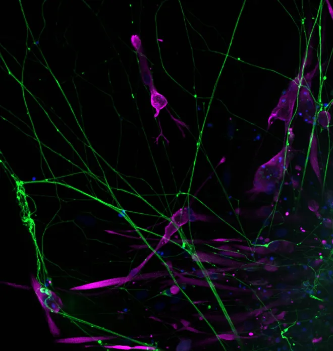 Green neurons invade the calm world of muscles, chaos meets contraction.