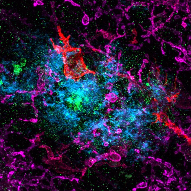 Wibbly wobbly timey wimey - Staining for P2RY12 (magenta), X-34 (blue), HLA (red), and LAMP2 (green).