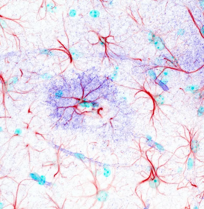 Celestocyte