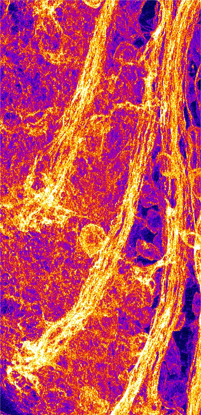 Axonal inferno shows proximal axon bundles in the larval Drosophila brain
