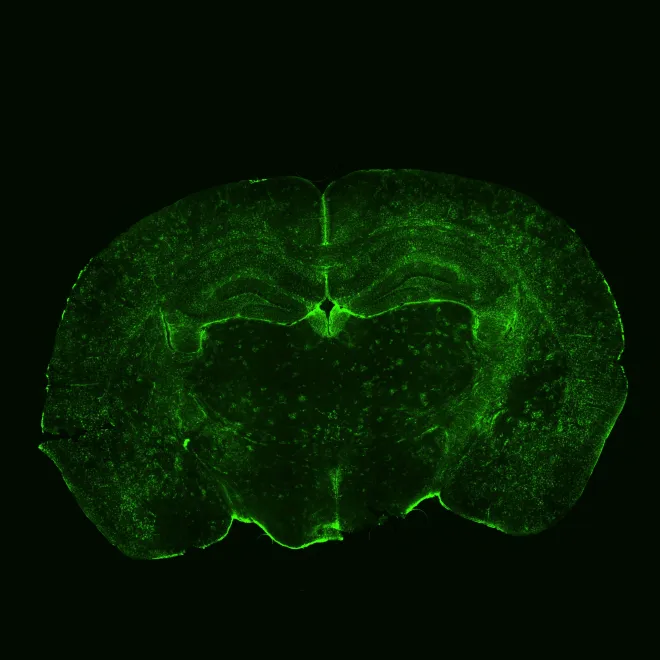 Bulldog brain