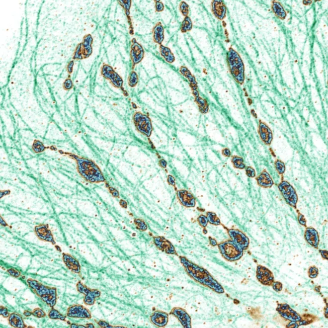 Pearls of mitochondria