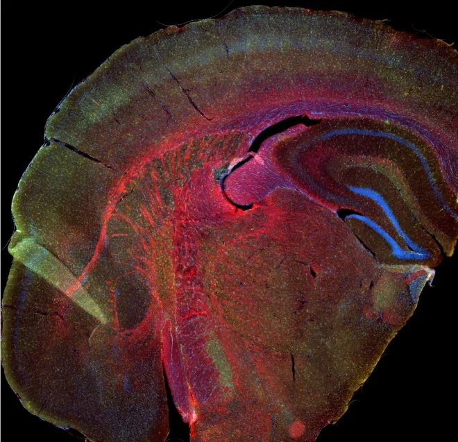 A totally normal mouse brain