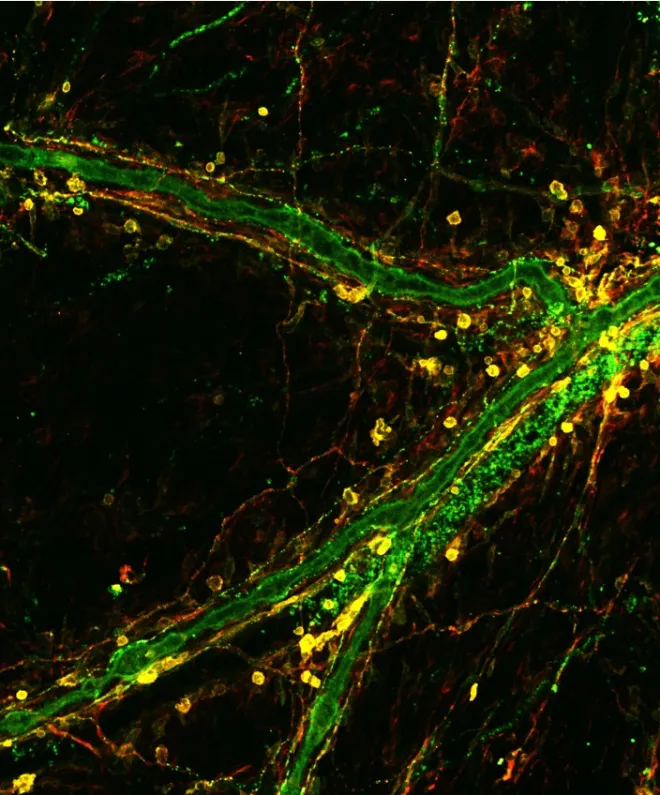 Heaps of mates infiltrating the dura mater for free Papegaei