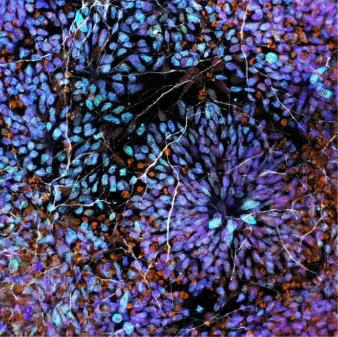 Maximum intensity projection neural progenitor cells forming rosettes
