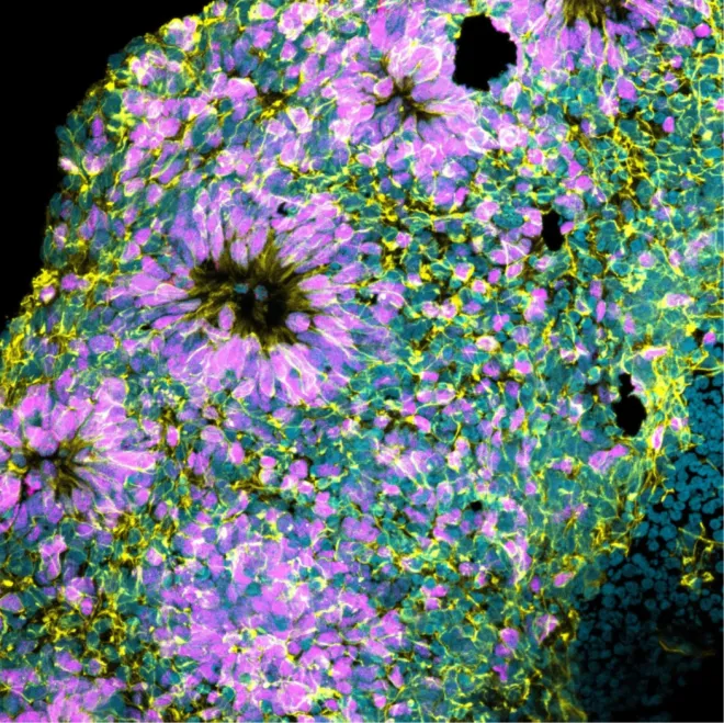 maximum intensity projection of a dorsal forebrain organoid demonstrating neural rosette formation